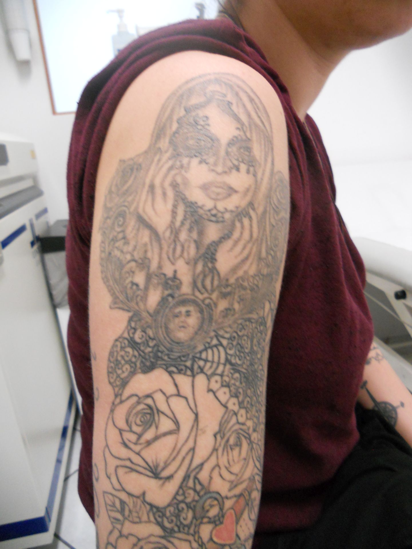 Anita-nach-der-ersten-Behanldung-1