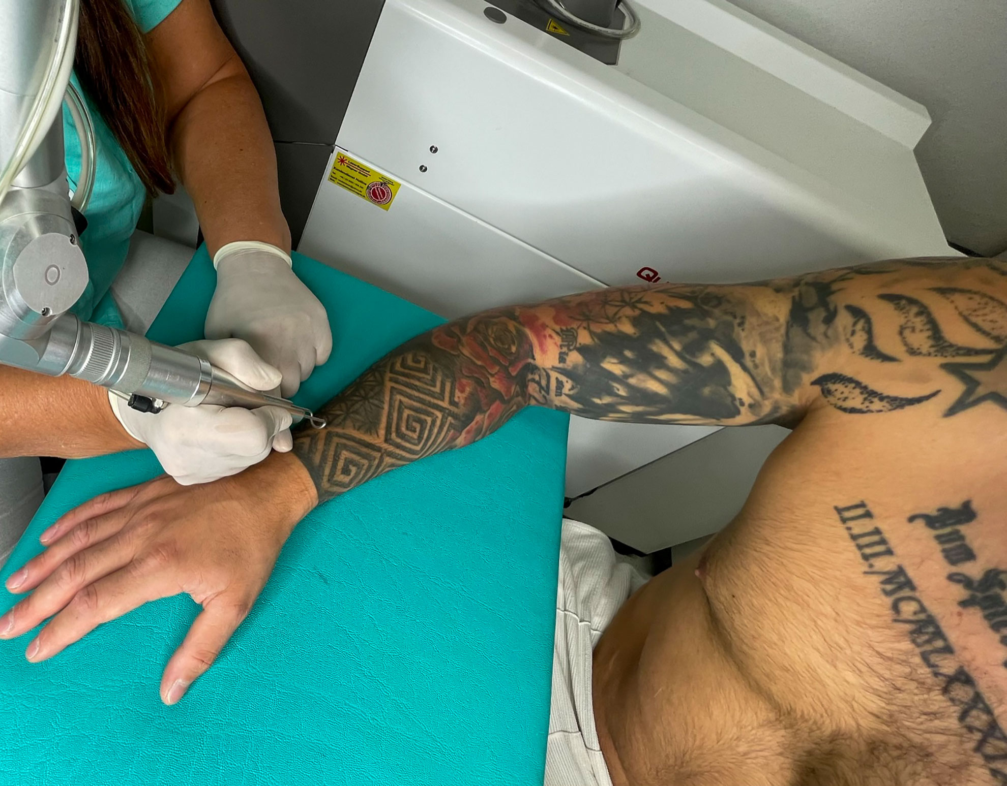 tattoo-piercing-laser-tattoo-entfernung-in-münchen