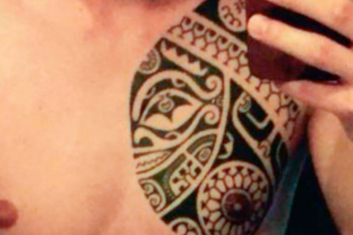 vor-der-tattooentfernung-aesthetic-art-muenchen-passauer-strasse 1 behandlung