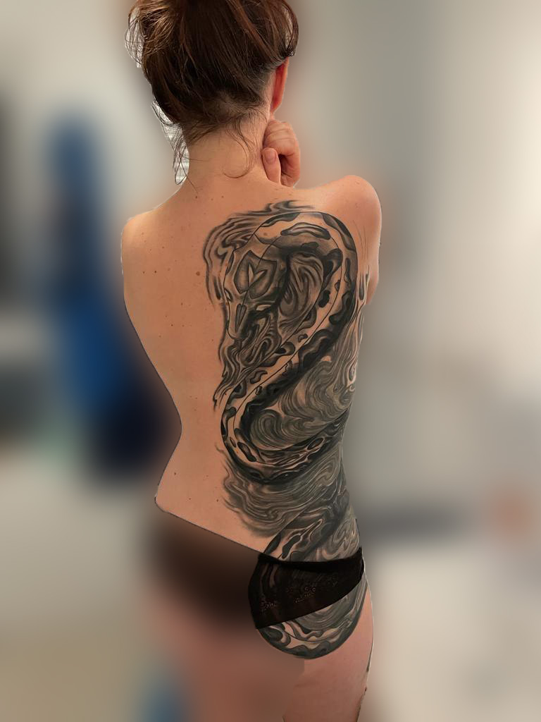 tattooentfernung-vorher